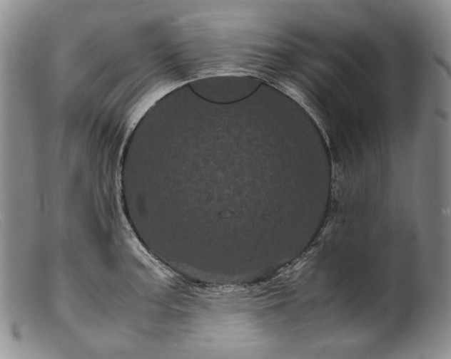 X0000099431187200805231646