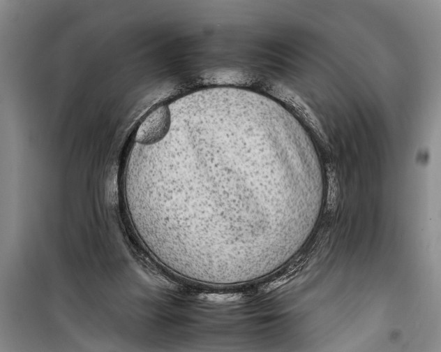 X0000099430251200805301435