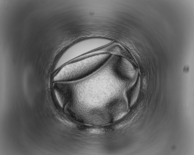 X0000099430303200805301435