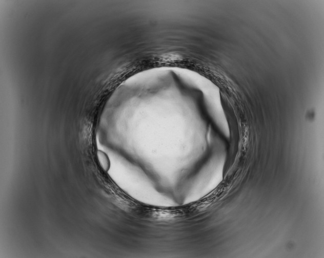 X0000099430565200805301431