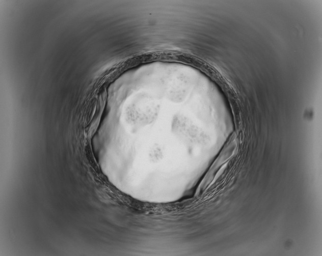 X0000099431063200805301424