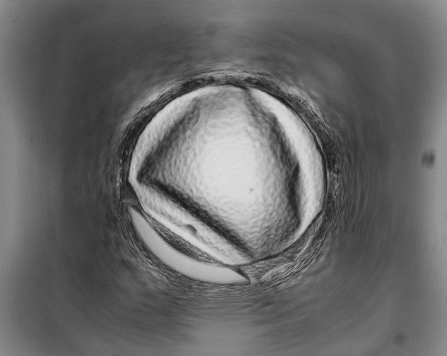 X0000099431159200805301422