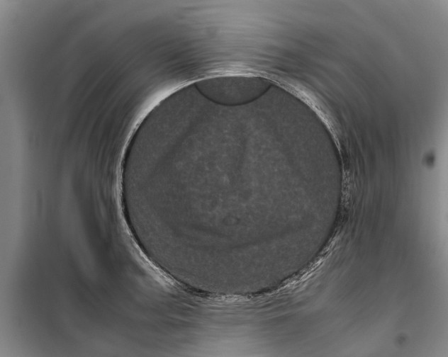 X0000099431187200805301422