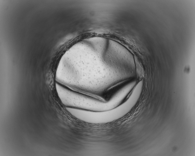 X0000099431398200805301419