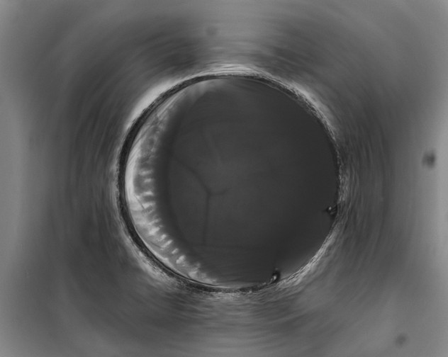 X0000099431422200805301419