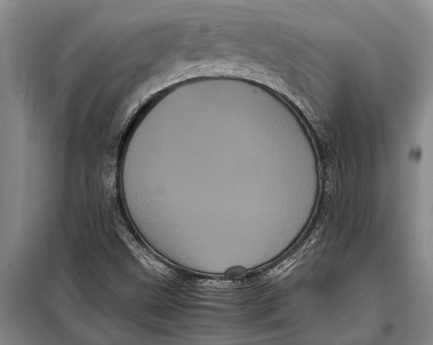 X0000099431499200805301417