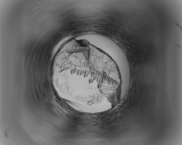 X0000099430147200806061028