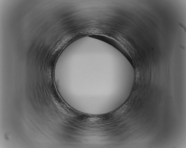 X0000099430158200806061028