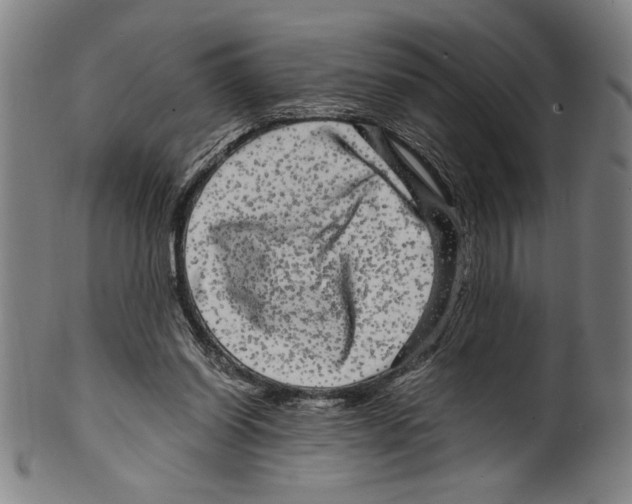 X0000099430254200806061026