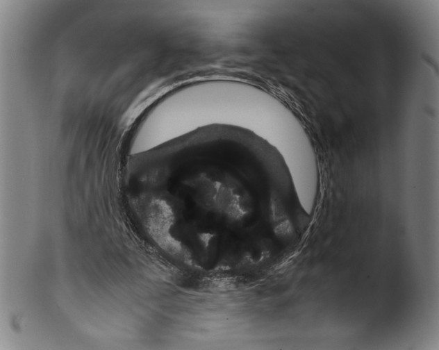 X0000099430295200806061026