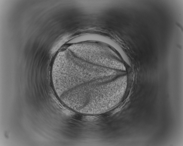 X0000099430341200806061025