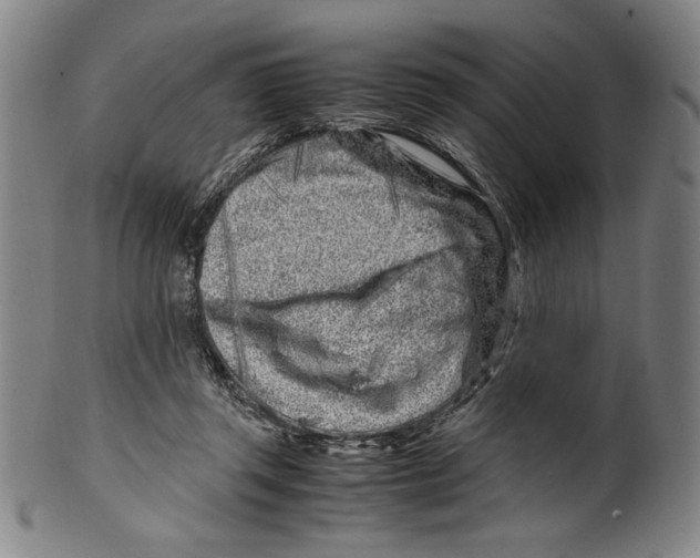 X0000099430357200806061025