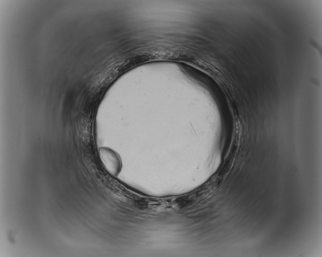 X0000099430499200806061023