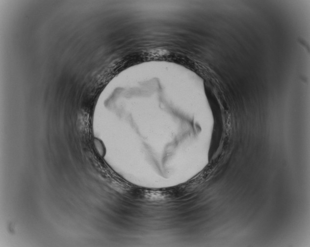 X0000099430565200806061022