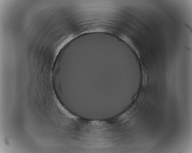 X0000099430805200806061018