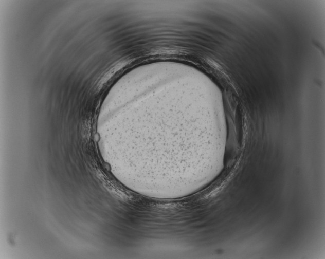 X0000099431017200806061014