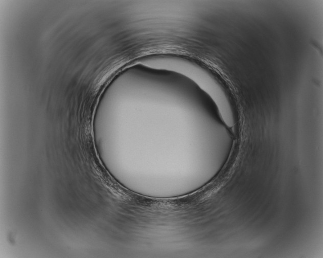 X0000099431073200806061013