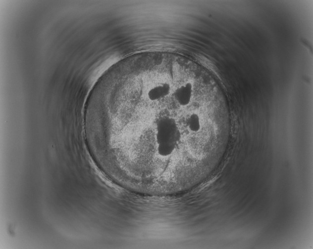 X0000099431087200806061013