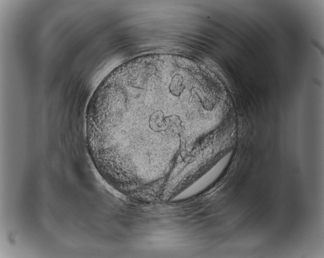 X0000099431095200806061013