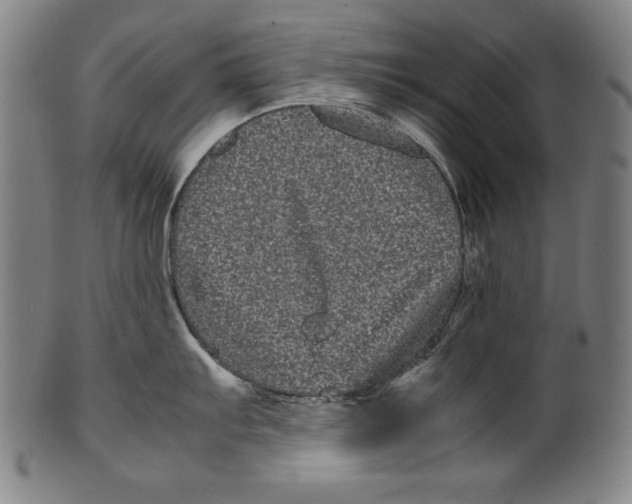 X0000099431103200806061013