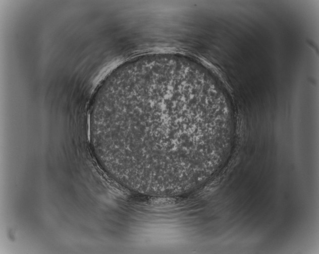 X0000099431171200806061012