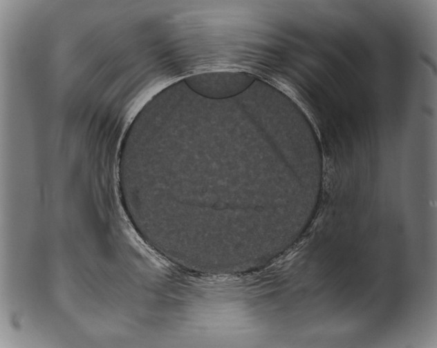 X0000099431187200806061011