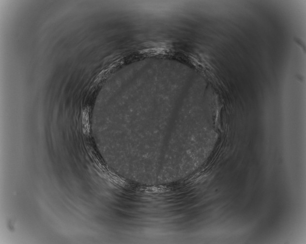 X0000099431203200806061011