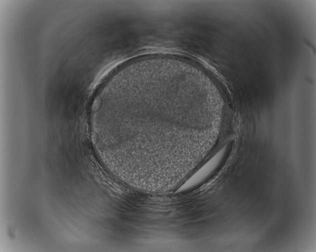 X0000099431215200806061011