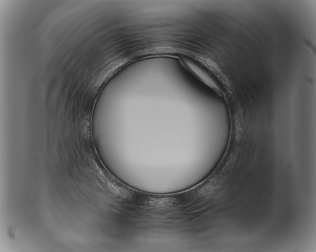 X0000099431225200806061011