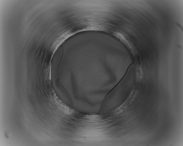 X0000099431276200806061010