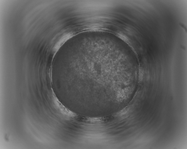 X0000099431338200806061010