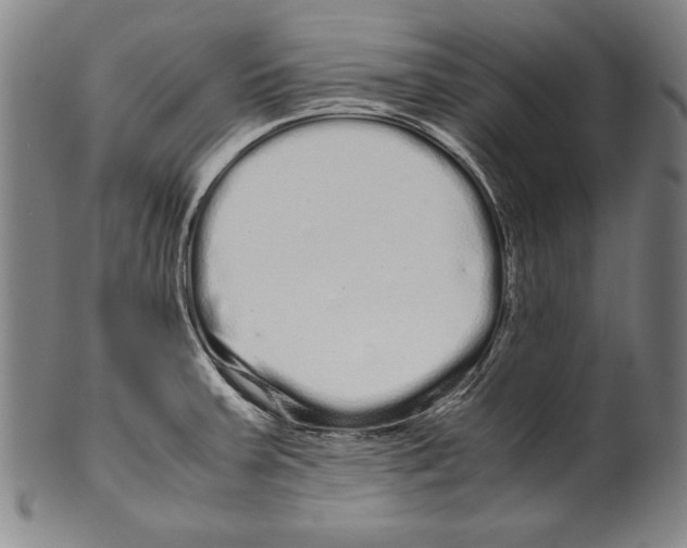 X0000099431379200806061008