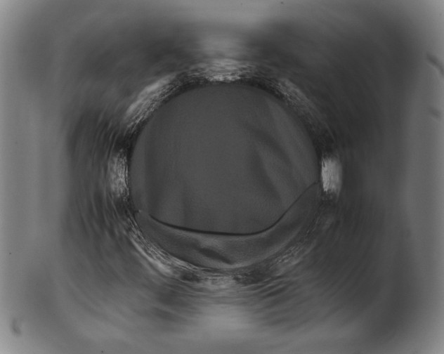 X0000099431444200806061007