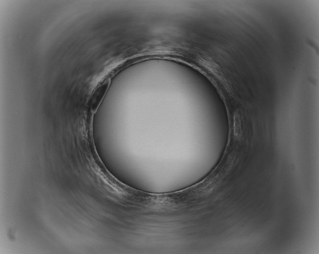 X0000099431452200806061007