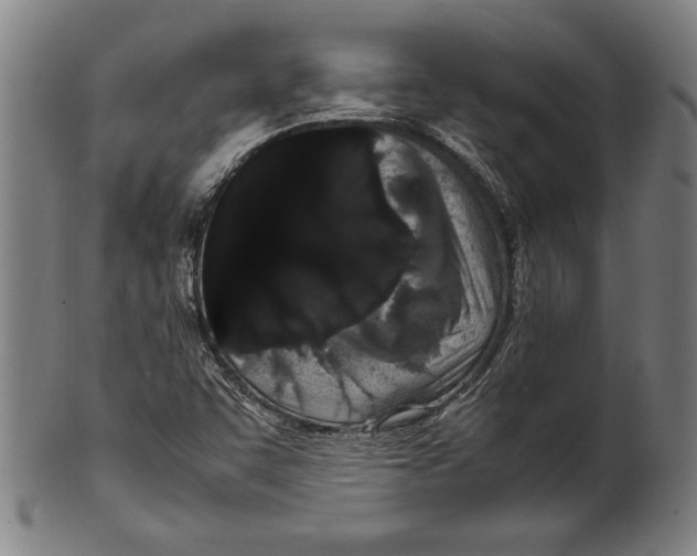 X0000099431455200806061007