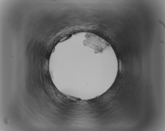 X0000099431492200806061006