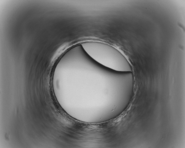 X0000099440151200805090755