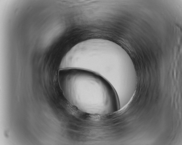 X0000099440190200805090755