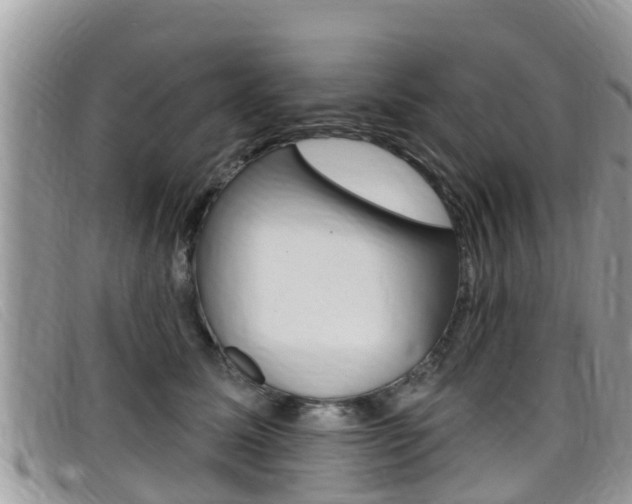 X0000099440611200805090749