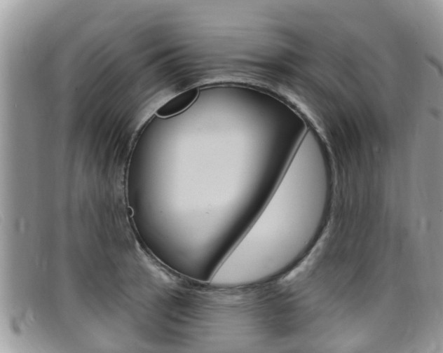 X0000099441137200805090742