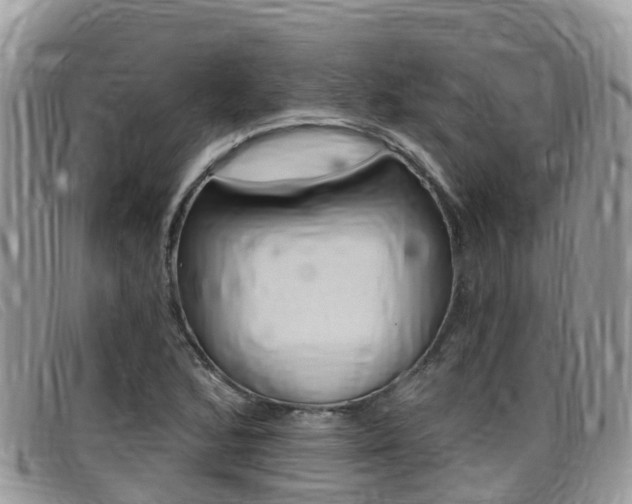 X0000099441168200805090741