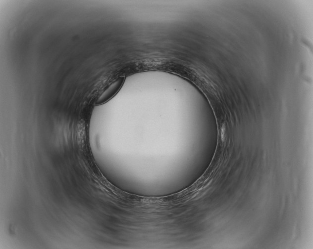 X0000099441299200805090739