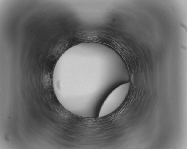 X0000099441395200805090738