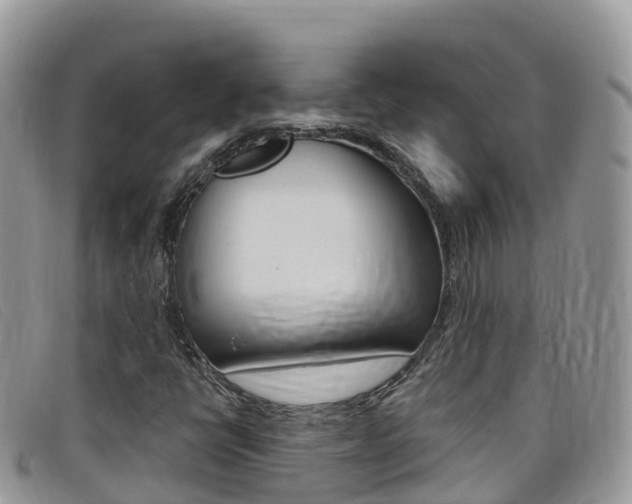 X0000099441398200805090738