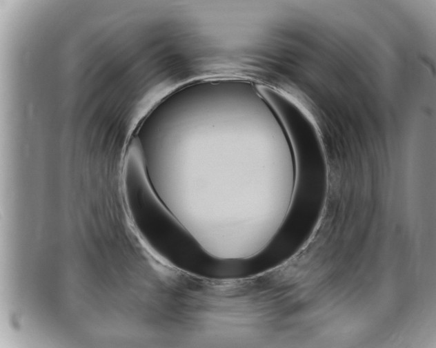 X0000099441485200805090737
