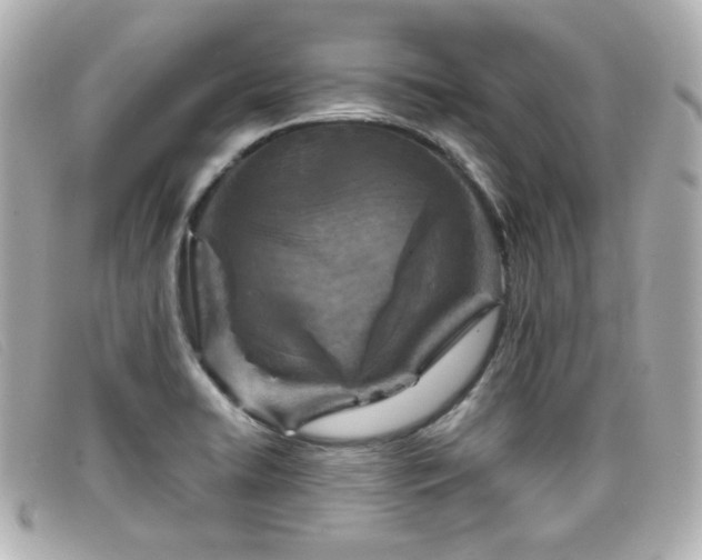 X0000099441422200805091302