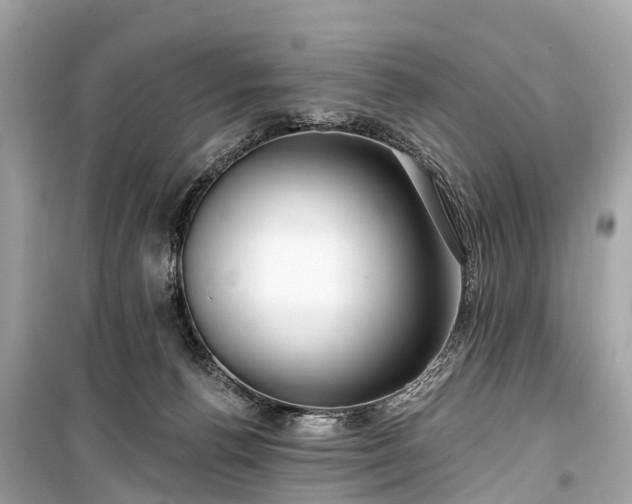 X0000099440176200805161143