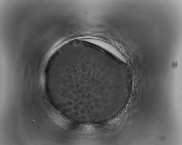 X0000099440295200805161140