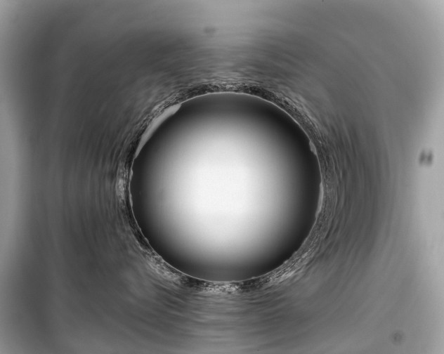 X0000099440576200805161136