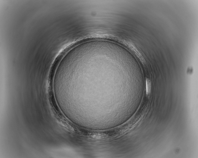 X0000099440579200805161136